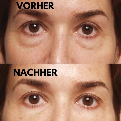 Eye Cream Depuffing & Brightening Fast Absorbing 20ml