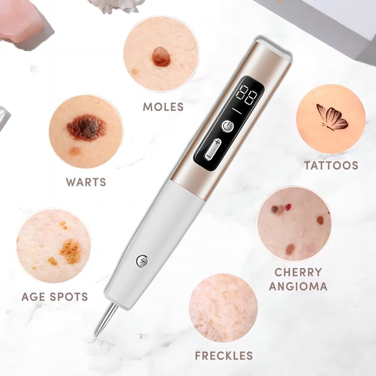 Skin Tag Remover Pen with Adjustable Laser Levels, Rechargeable Skin Care Device, Home Mole Remover with LCD Display