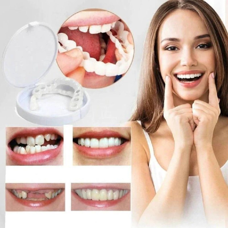 Kit de carillas dentales fácil para una sonrisa perfecta
