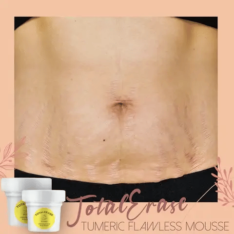 Body Mousse Reduces Stretch Marks Turmeric & Argan Oil