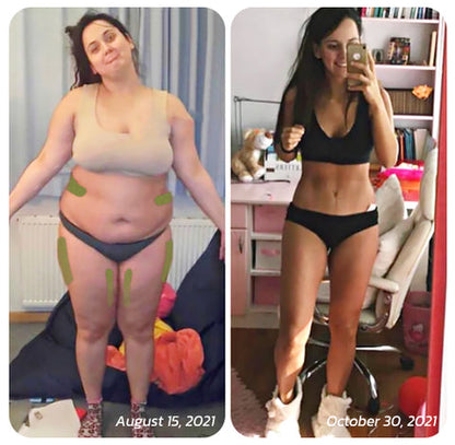 Patch for Reducing Cellulite - Natural Formula