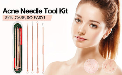 Cuidado esencial de la piel | Kit de herramientas extractoras de granos con acero inoxidable seguro | Eliminación profesional de puntos negros para un cutis limpio