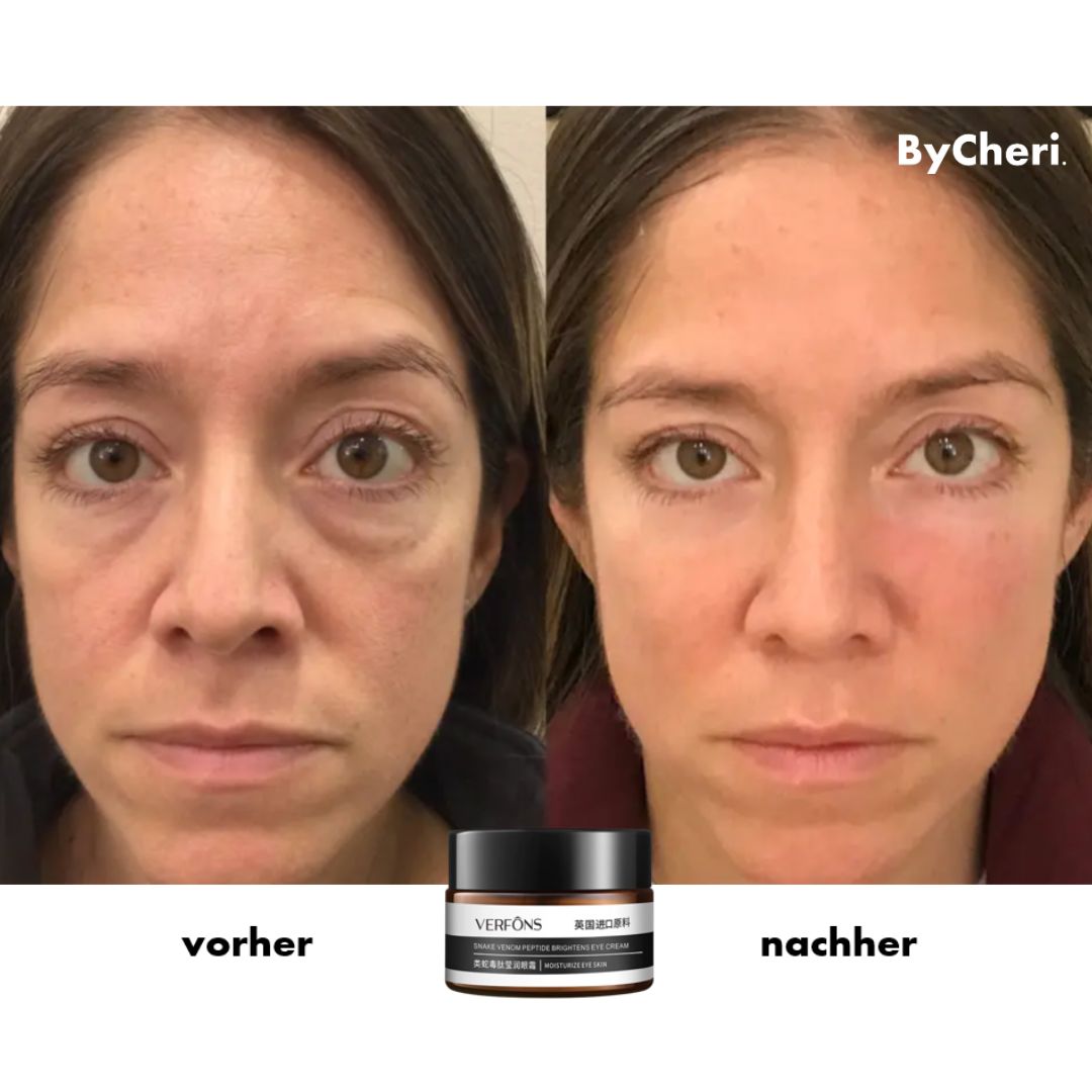 Compra uno y llévate otro gratis | Crema de ojos antiarrugas para el rejuvenecimiento