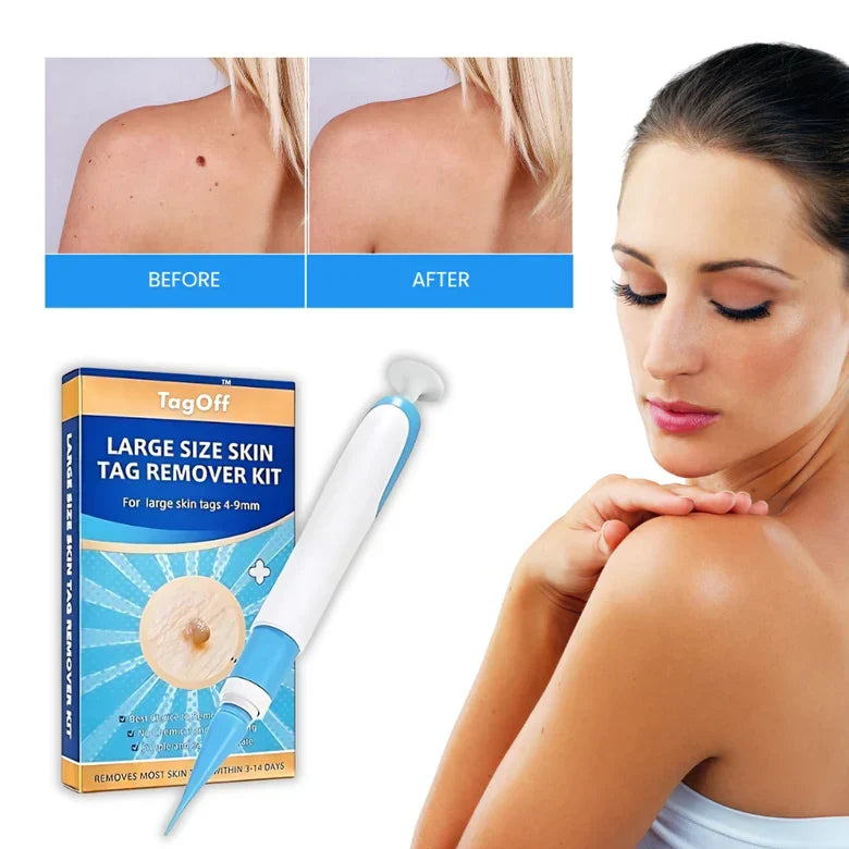 Skin Tag Remover Serum for Face Neck Body | Gentle Topical Treatment for Unwanted Skin Tags Fast Acting Formula | Works on Armpits Arms