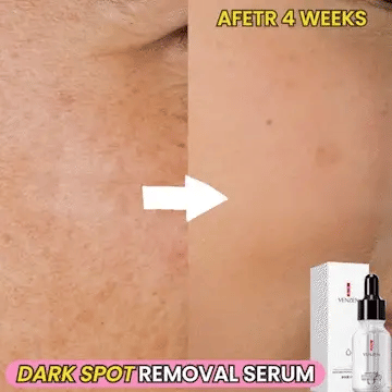 Dark Spot Correction Serum Fast-Acting Plant-Based
