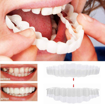 Snap-On Cosmetic Dental Veneers for Top and Bottom Teeth - Instant Smile Makeover Cover for Crooked, Stained, Missing Teeth - No Dentist Nee