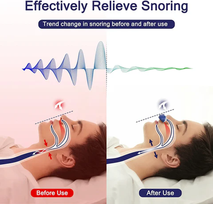 Portable Micro Anti-Snore Sleep Aid Device | USB Rechargeable Nasal Airway Support | Quiet Mask-Free CPAP Alternative for Travel & Home