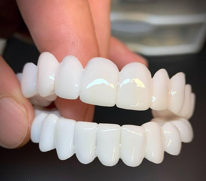 Snap-On Cosmetic Teeth Veneers for Covering Gaps, Stains & Missing Teeth – Reusable Smile Enhancement for Daily Confidence & Special Events
