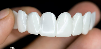 Removable Smile Veneers – Temporary Cosmetic Teeth Covers for Gaps, Stains & Chips – Custom-Mold Upper Arch for Confident Speaking & Eating