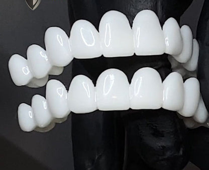 Removable Smile Veneers – Temporary Cosmetic Teeth Covers for Gaps, Stains & Chips – Custom-Mold Upper Arch for Confident Speaking & Eating