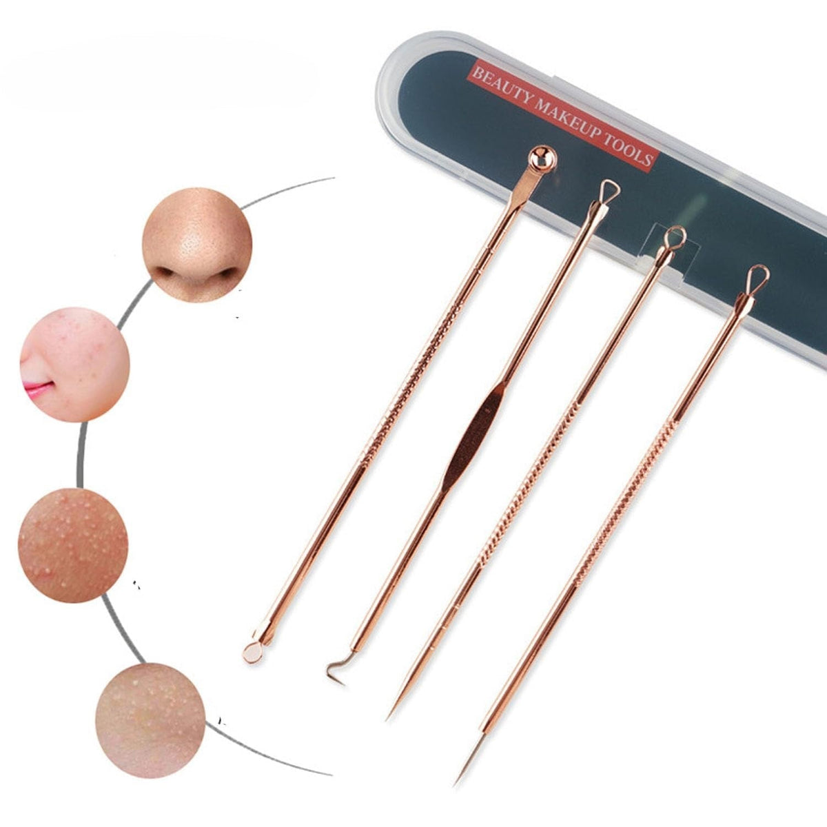 Cuidado esencial de la piel | Kit de herramientas extractoras de granos con acero inoxidable seguro | Eliminación profesional de puntos negros para un cutis limpio