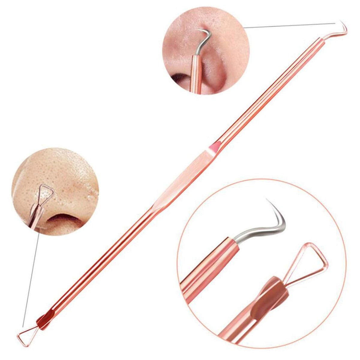 Cuidado esencial de la piel | Kit de herramientas extractoras de granos con acero inoxidable seguro | Eliminación profesional de puntos negros para un cutis limpio