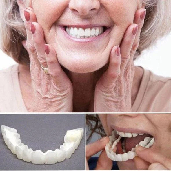 Kit de carillas para dientes superiores e inferiores Natural Smile