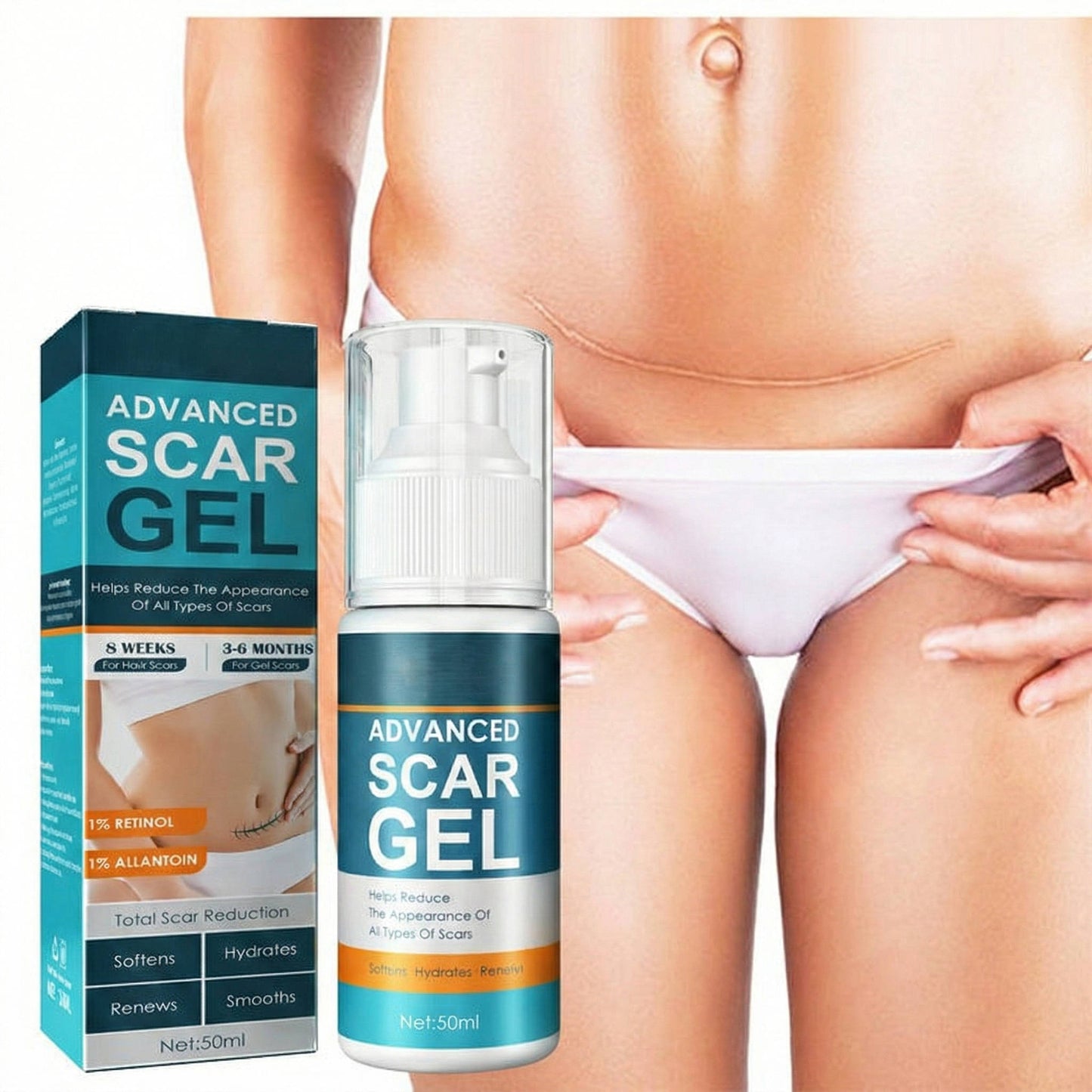 Silicone Scar Removal Cream for Fade Marks and Stretch Marks - Ortekor