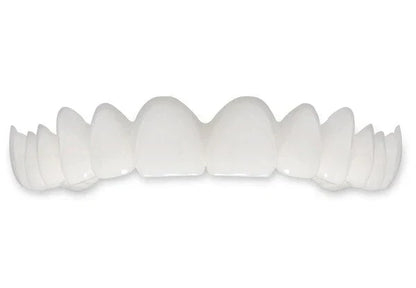 Removable Snap-On Veneers for Temporary Smile Makeover – Heat-Moldable Cosmetic Teeth Covers for Top Teeth