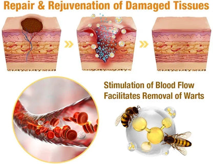 Skin Tag Removal Spray with Natural Bee Venom Extract for At-Home Treatment of Tags, Warts & Moles