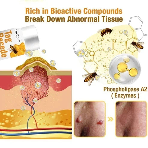 Skin Tag & Wart Removal Spray with Natural Bee Venom Extract for Blemish-Free Complexion at Home Treatment