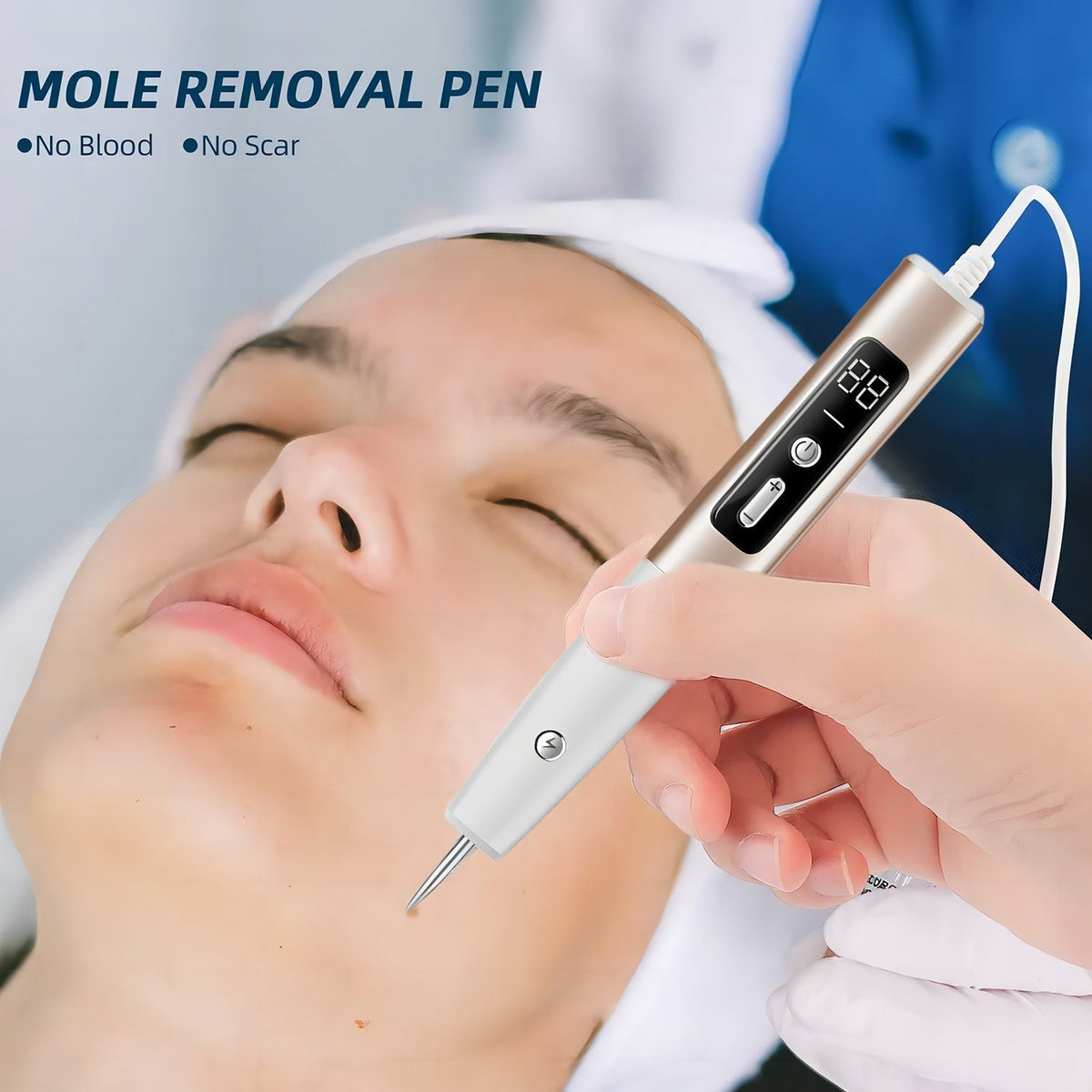 Skin Tag Remover Pen with Adjustable Laser Levels, Rechargeable Skin Care Device, Home Mole Remover with LCD Display