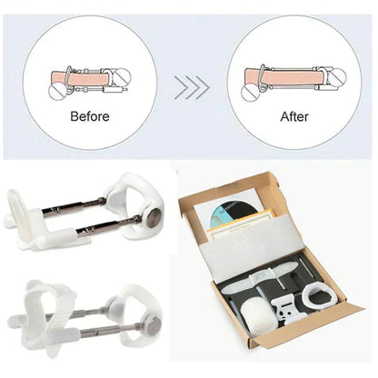 Pro Extender | Adjustable Traction Device with Durable Materials | Gentle Support for Natural Tissue Adaptation