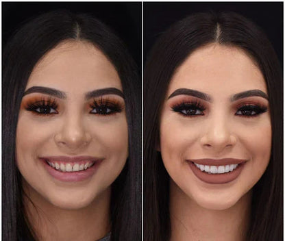 Snap On Veneers for Upper and Lower Teeth, Moldable Custom Fit Removable Teeth Veneers, Cosmetic Fake Teeth Cover