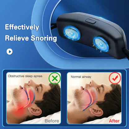 Snooze Smart Device | Anti-Snoring, USB Rechargeable