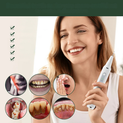 Ultrasonic Teeth Cleaning Device for Tartar Removal