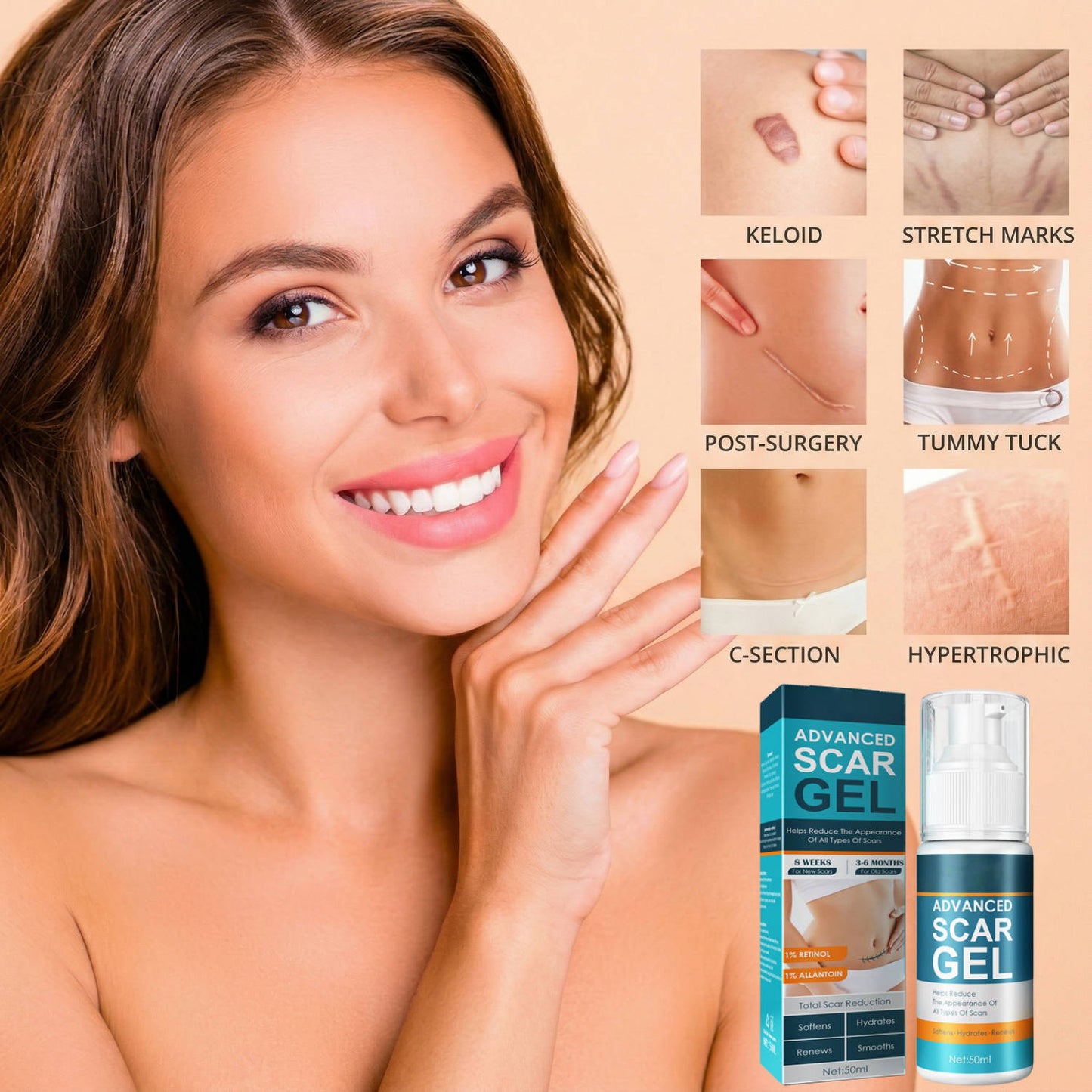 Crema de silicona para eliminar cicatrices y estrías