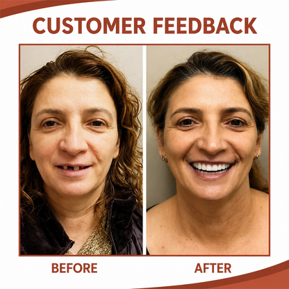 Soft Silicone Denture Cushion Liner for Comfortable Fit Without Pain or Slipping | Easy Home Application | Upper & Lower Arch Support