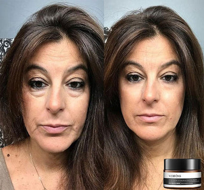 Compra uno y llévate otro gratis | Crema de ojos antiarrugas para el rejuvenecimiento