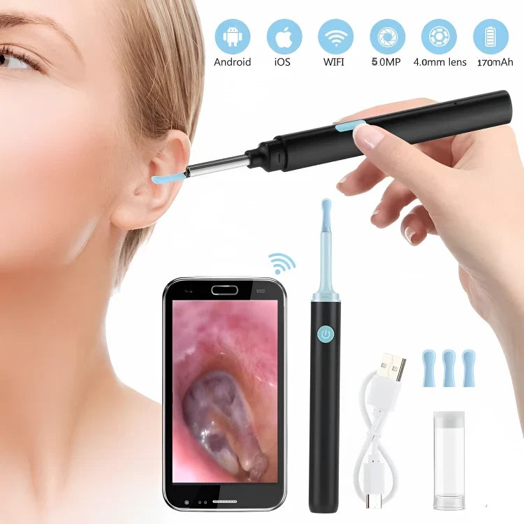 Endoscopio para extracción de cerumen con cámara HD, puntas de silicona y conector tipo C