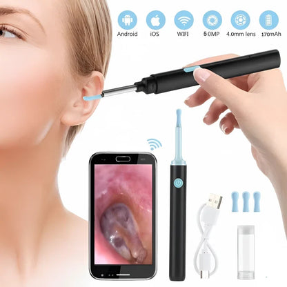 Endoscopio para extracción de cerumen con cámara HD, puntas de silicona y conector tipo C