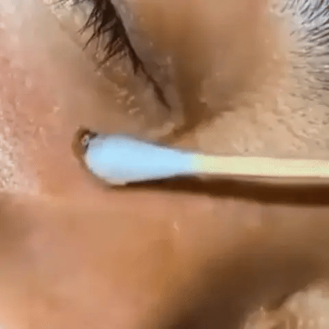 Sérum corrector de manchas oscuras iluminador de cúrcuma