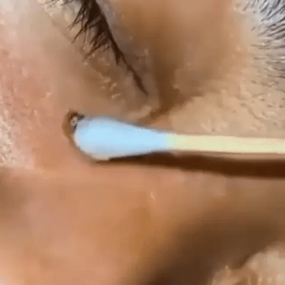 Sérum corrector de manchas oscuras iluminador de cúrcuma