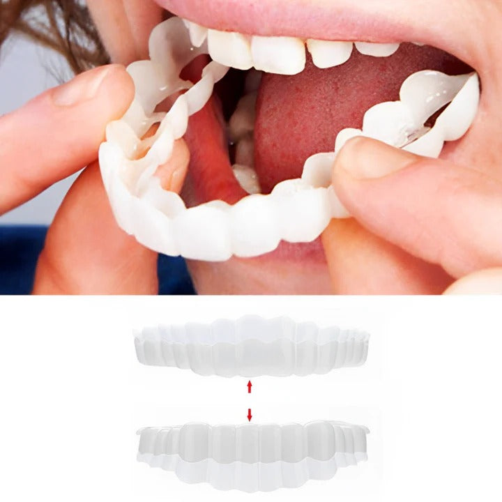 Carillas de Quita y Pon Easy Fit para Dientes Superiores e Inferiores