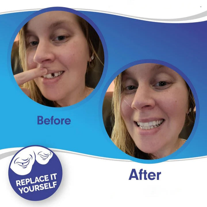 Carillas de Quita y Pon Easy Fit para Dientes Superiores e Inferiores