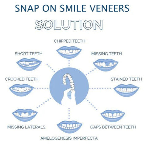 Carillas de Quita y Pon Easy Fit para Dientes Superiores e Inferiores