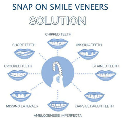 Carillas de Quita y Pon Easy Fit para Dientes Superiores e Inferiores