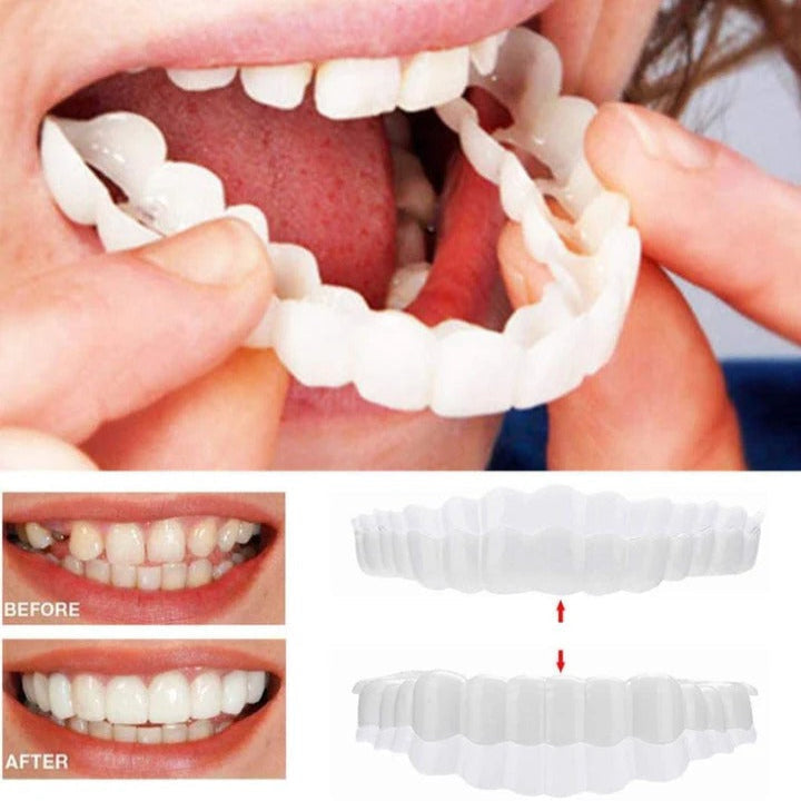 Carillas de Quita y Pon Easy Fit para Dientes Superiores e Inferiores