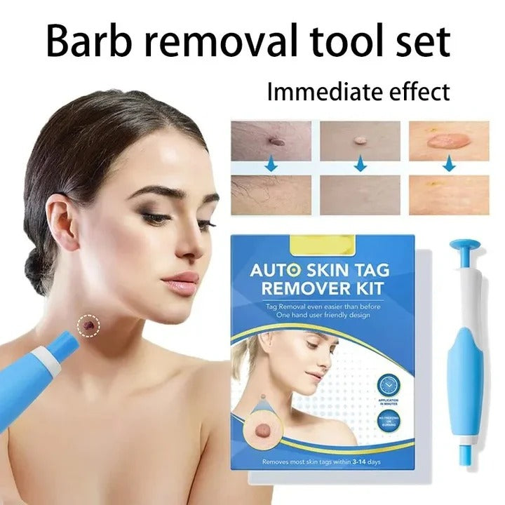 Kit de eliminación fácil de verrugas cutáneas con aplicador