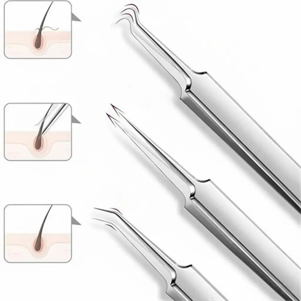 Stainless Steel Pore Extractor Tools for Acne, Clogged Pores, and Blemish Care at Home – Professional Skincare Set