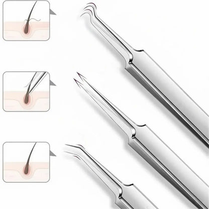 Stainless Steel Pore Extractor Tools for Acne, Clogged Pores, and Blemish Care at Home – Professional Skincare Set
