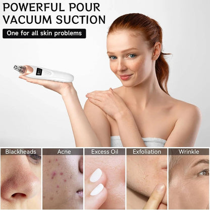 Limpiador Facial Profundo Portátil con Control de Succión Suave