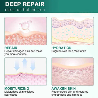 Crema de silicona para eliminar cicatrices y estrías