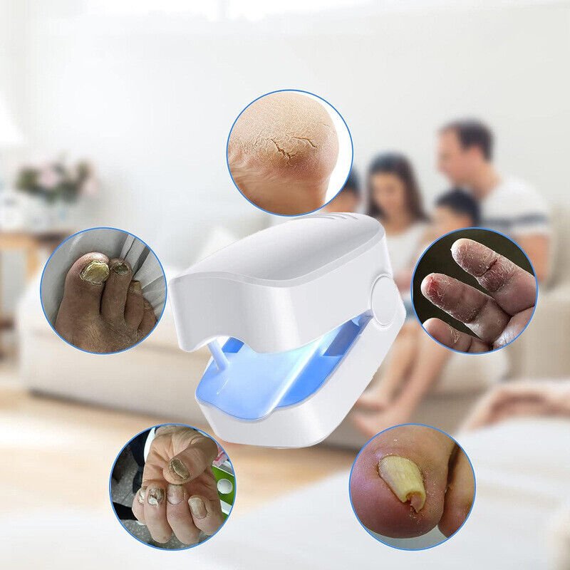 Portable Laser Treatment Pen for Toenail Fungus – 7-Minute Light Therapy Device for Nail Health & Clarity at Home