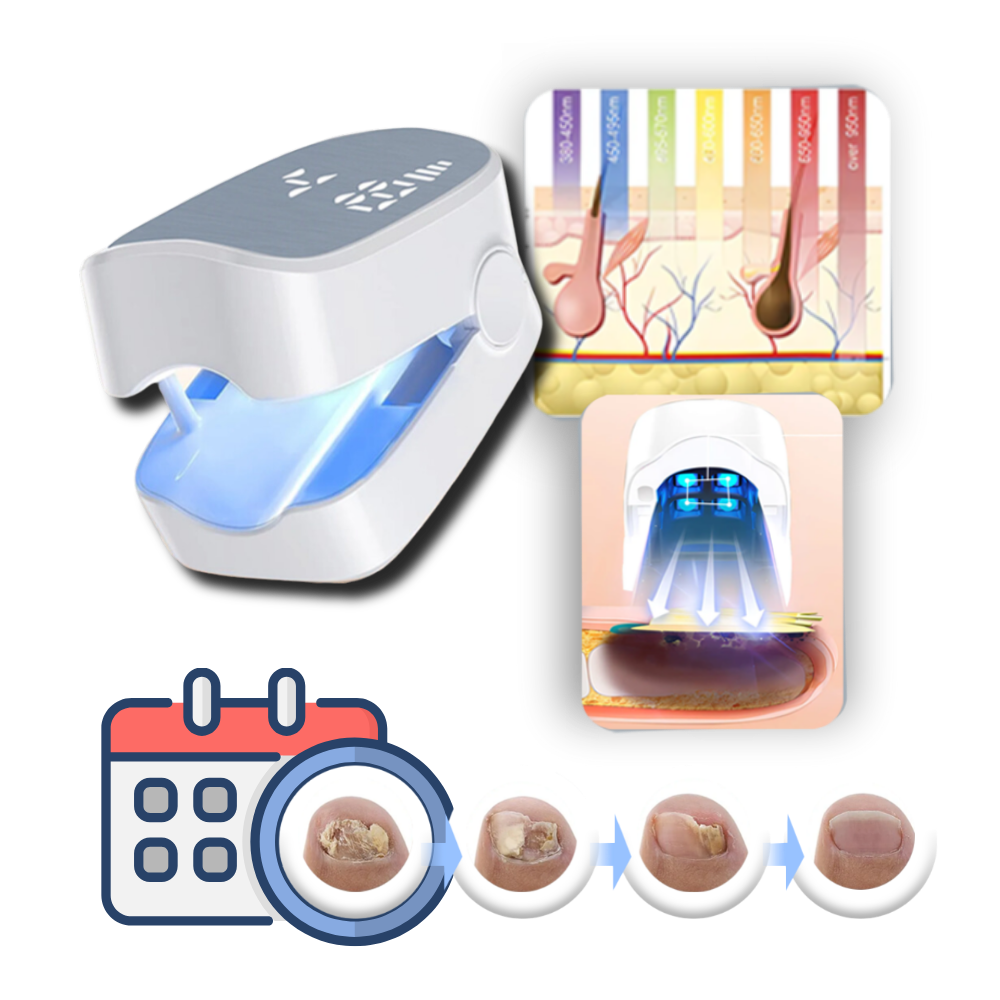 Dispositivo de láser frío para hongos en las uñas, dispositivo láser para uñas con modo de pulso, dispositivo láser para uso doméstico, herramienta de cuidado de uñas para los dedos de los pies