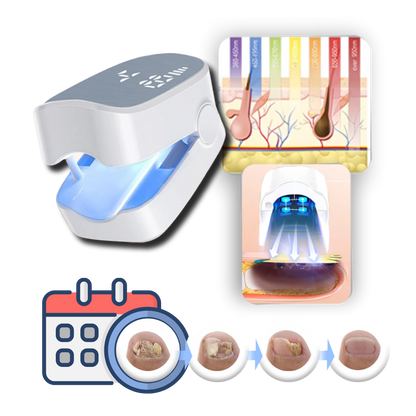 Dispositivo de fototerapia recargable para el cuidado de las uñas, tratamiento de modo dual con LED azul y láser frío, portátil para uso diario de 7 minutos para uñas de los pies y
