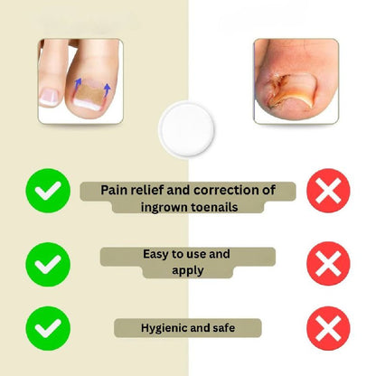 Reparación Rápida de Uñas para Uñas Rotas y Encarnadas