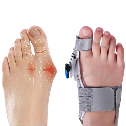 Adjustable Toe Straightener with Hinge System for Hallux Valgus Relief & Foot Alignment – Silicone Spacer for Day & Night Support