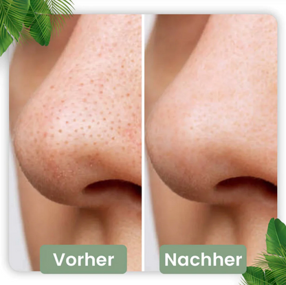 Barra de limpieza profunda para una piel radiante | Infusión de té verde natural