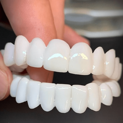 Snap-On Teeth Veneers for Upper Teeth | Temporary Cosmetic Dental Cover for Bright Confident Smile | Reusable Prosthetic Cap with Natural